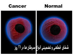 شفای تضمینی انواع سرطان ها در 21 روز!!!